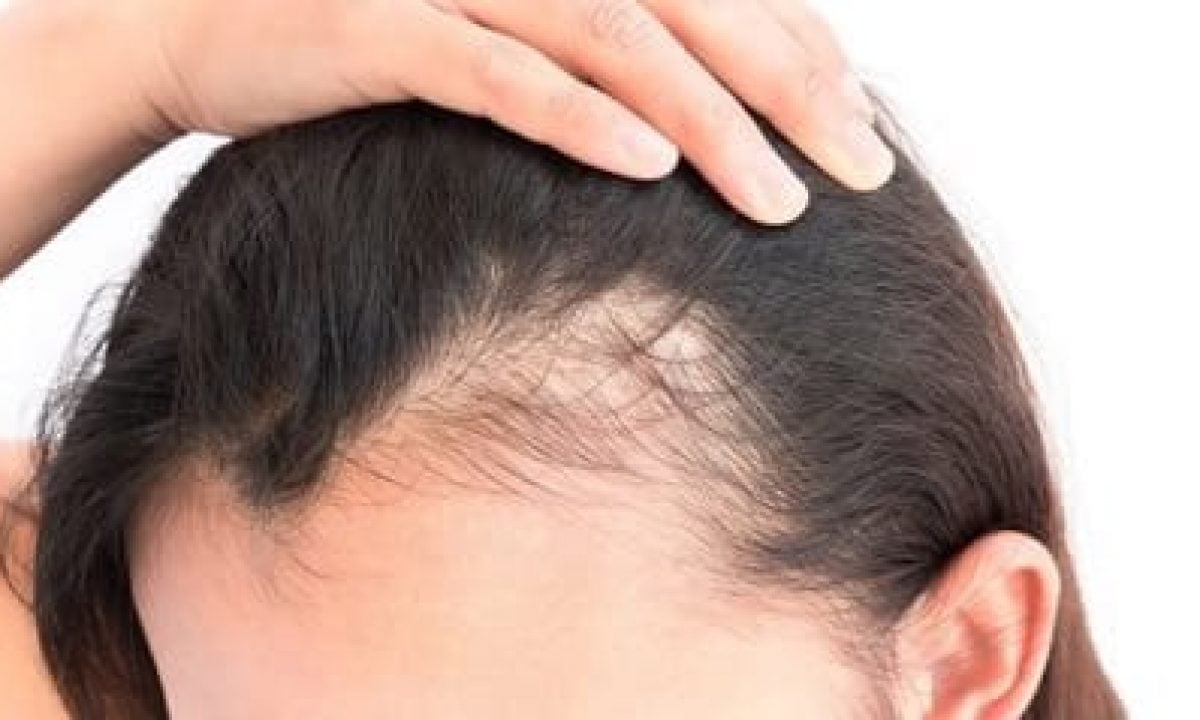 Como estrés puede acelerar la de cabello | Kmax España
