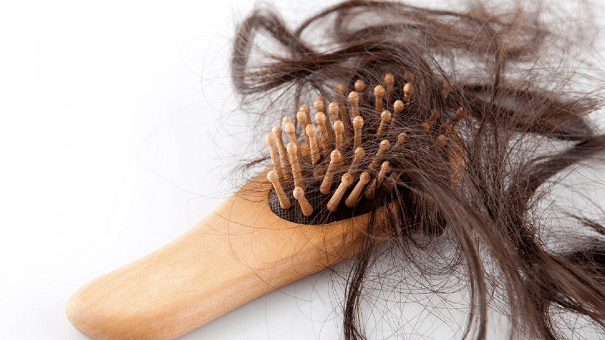 Pérdida cabello: Los mejores principios activos combatirla