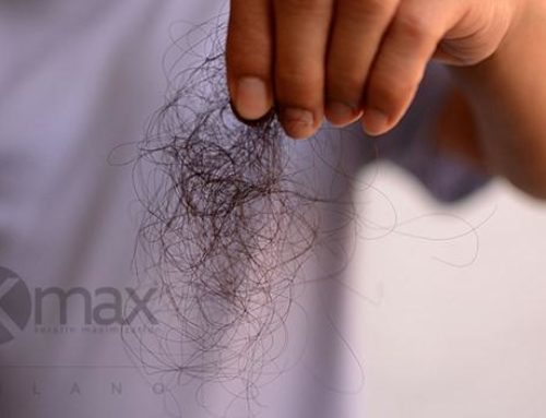Efluvio capilar: causas y trucos para favorecer el recrecimiento del cabello tras el efluvio