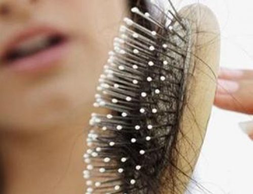 Efluvio telógeno: caída del cabello