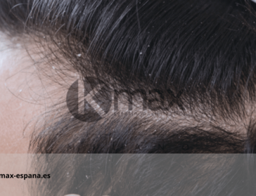 5 consejos para un cuero cabelludo más sano