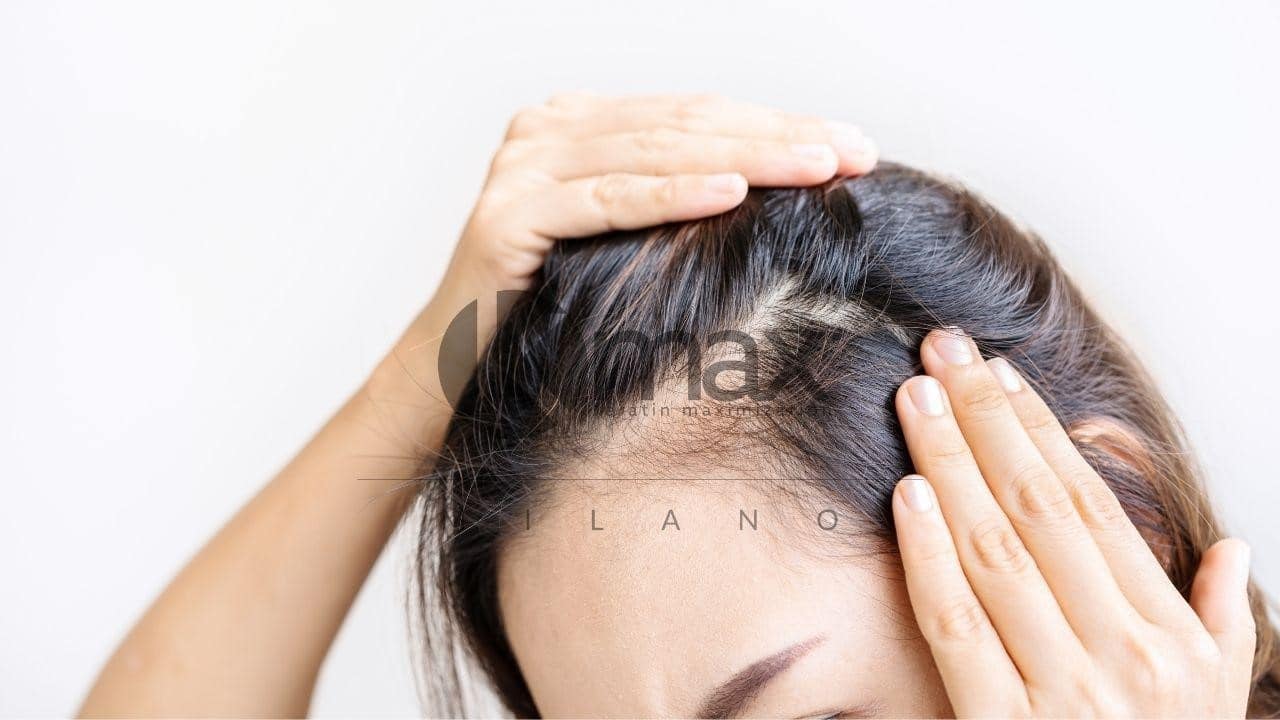 Alopecia causas y tratamientos por el Tricólogo - Kmax España