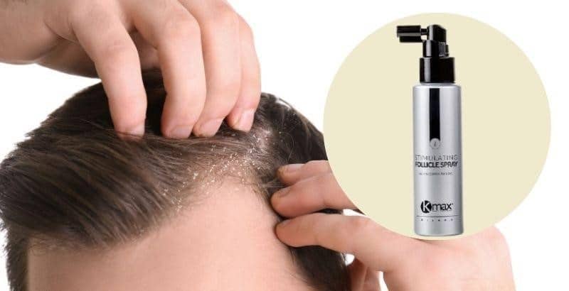 caída del cabello primavera: 6 consejos para reducirla - Kmax España