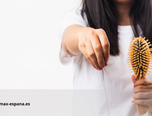 Alopecia femenina: causas y tratamientos explicados por el Tricólogo