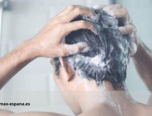 Los lavados después del injerto capilar