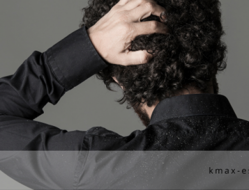 Diferencia entre caspa y descamación: Causas, tratamientos y prevención en el cuidado del cabello