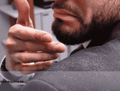 Cómo eliminar la caspa seca de forma eficaz y natural