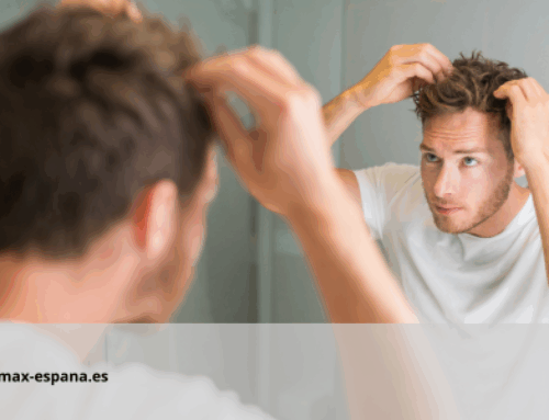 Productos para engrosar el cabello