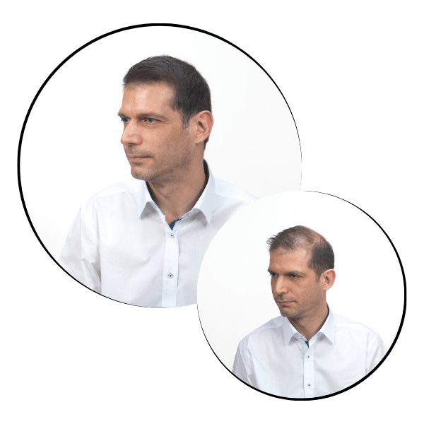 resultado-fibras-capilares-en-mujeres