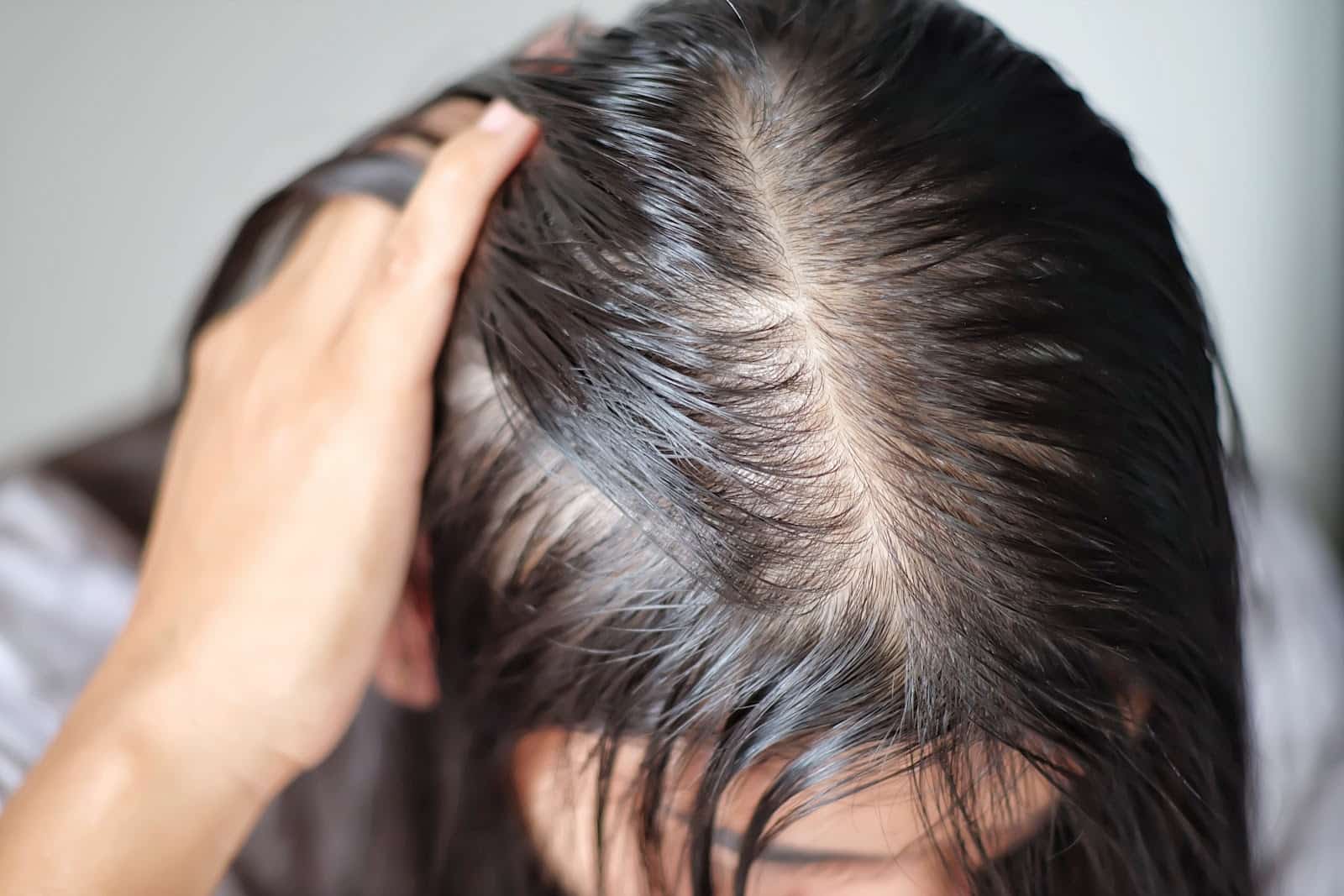 Noia amb excés de greix als cabells abans d'iniciar un Tractament amb Vitaminity Anti-Sebum