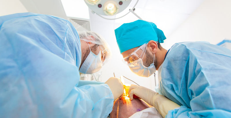 Equip de Cirurgià en una intervenció de trasplantament capil·lar