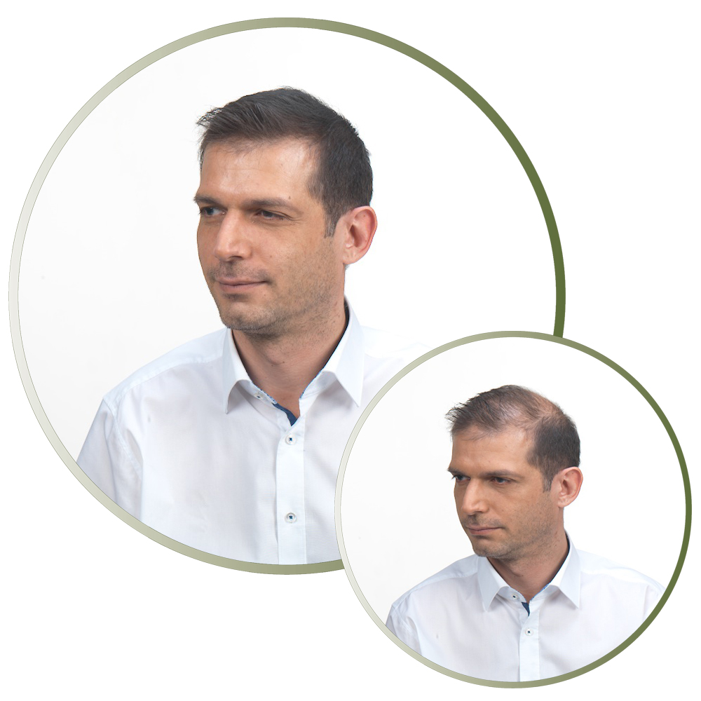 Comprar Fibras capilares castaño claro